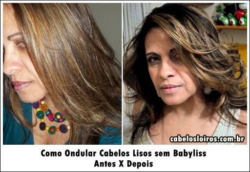 Vitamina B 12 vantagem de cabelo